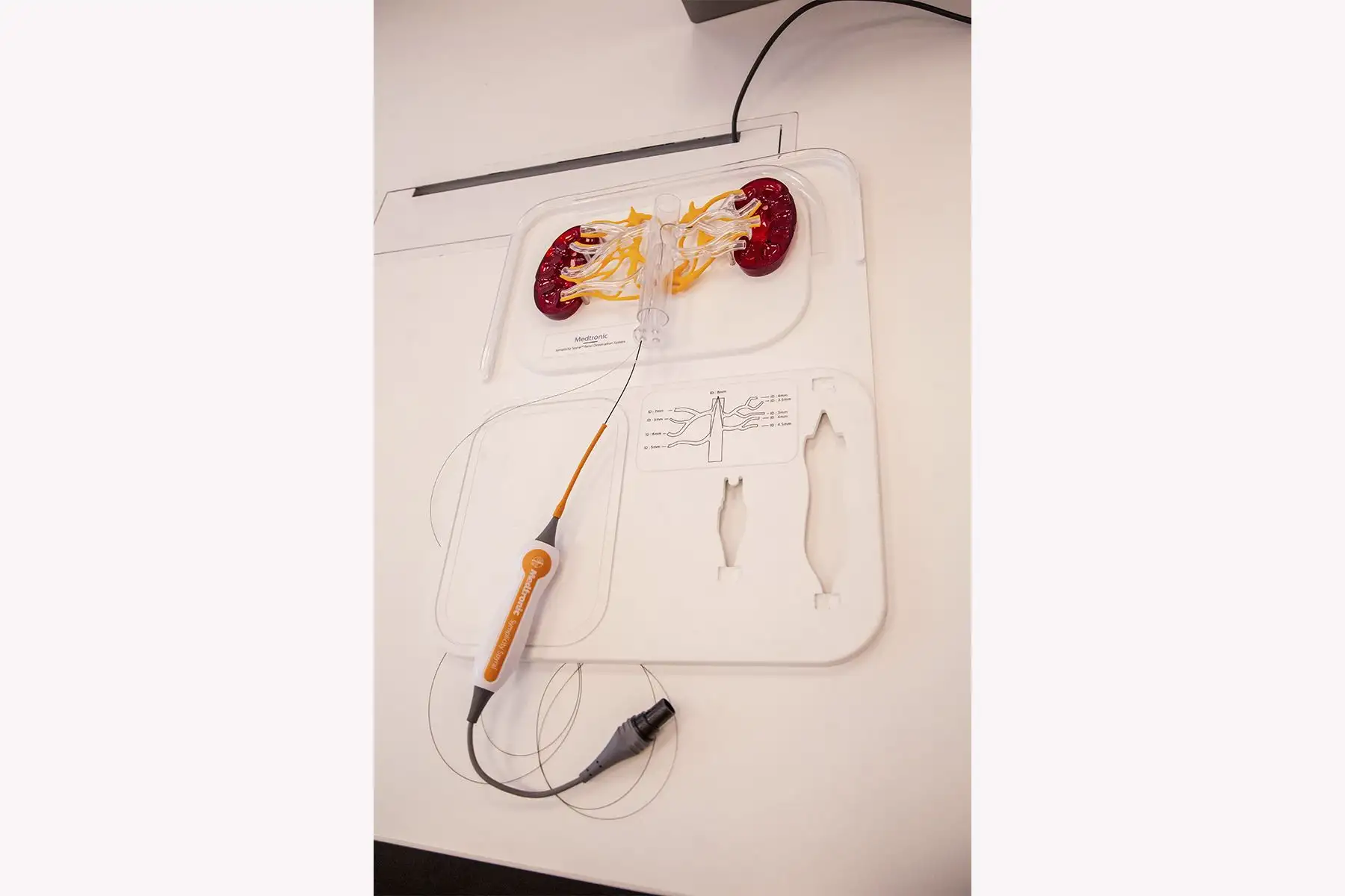 Sistema de denervación renal Symplicity Spyral de Medtronic, una tecnología basada en catéter diseñada para interrumpir las señales nerviosas que influyen en la presión arterial.