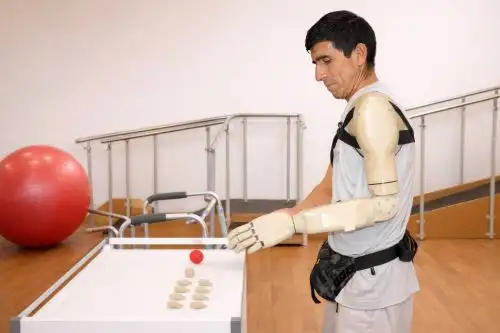 Paciente de Huánuco que perdió el brazo, ahora recibió una prótesis totalmente gratis en el INEN. Foto: ANDINA/Difusión