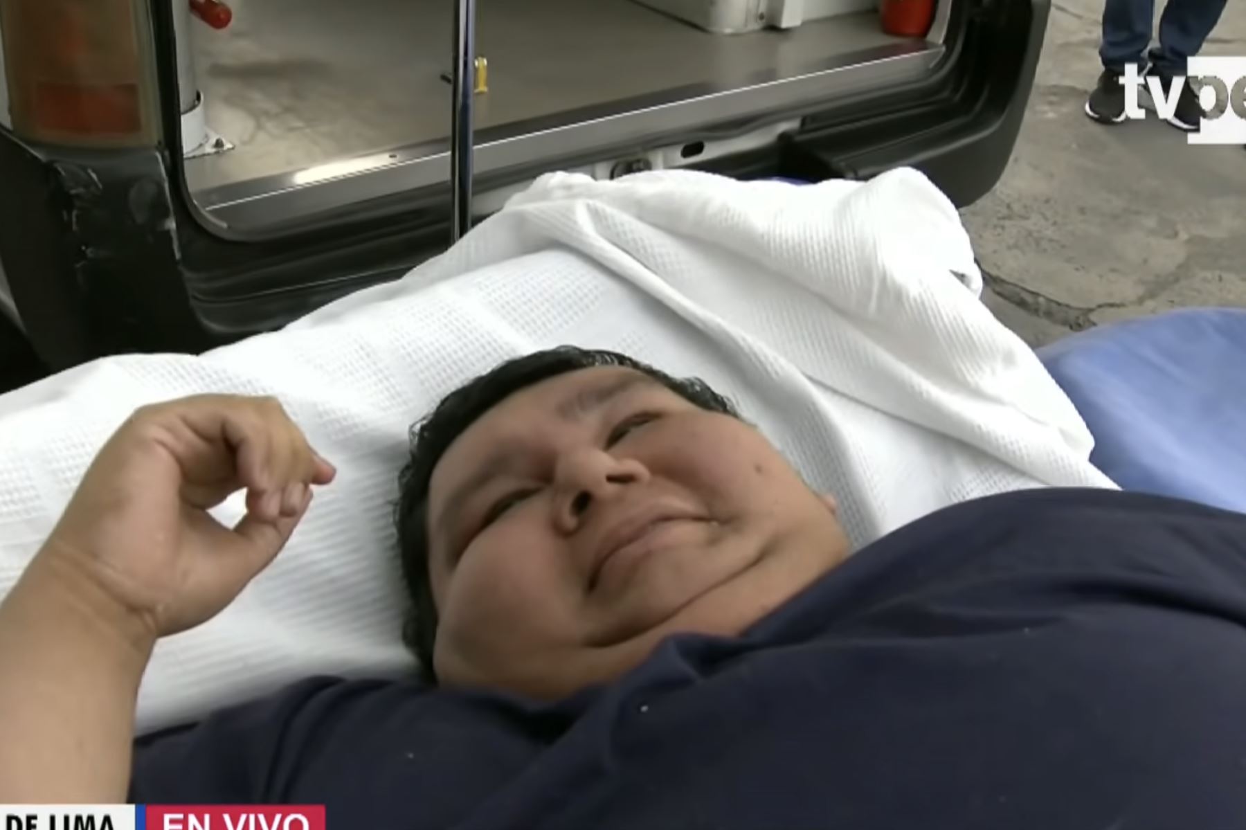Segunda oportunidad: Joven con 300 kilos fue intervenido con éxito en Hospital Dos de Mayo