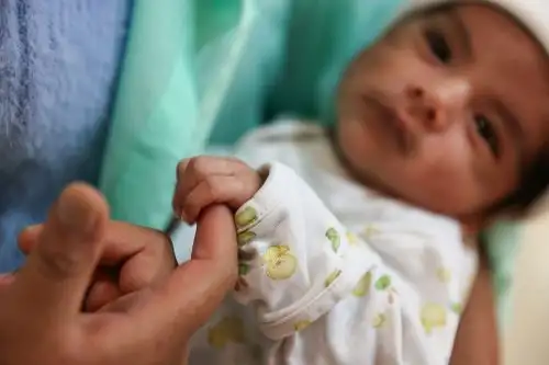 Bebe puneño es intervenido quirúrgicamente con éxito, de una hidrocefalia congénita en el INSN San Borja