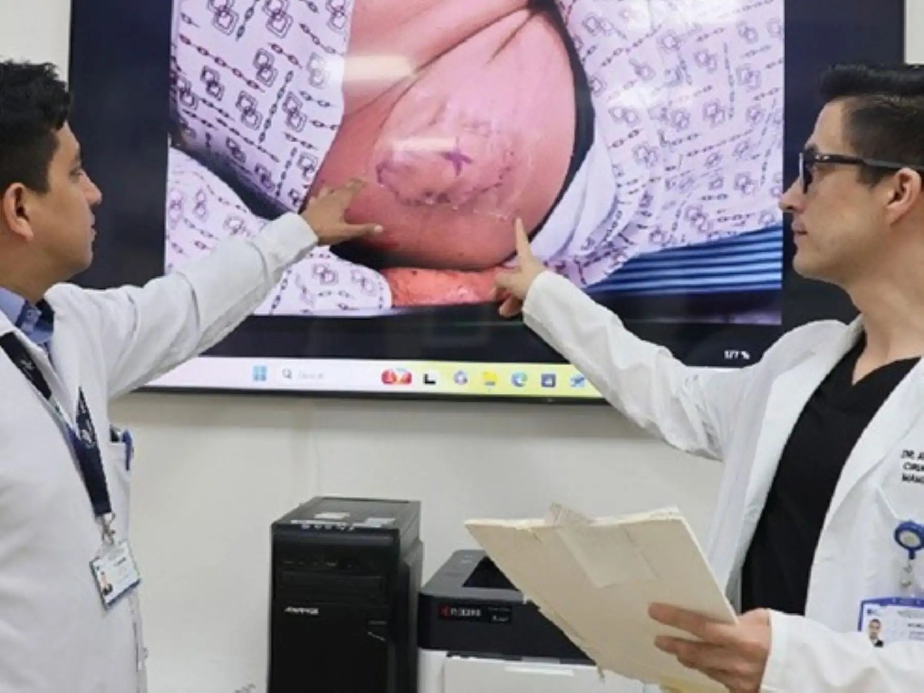 ¿Un bulto que crece y no duele? Podría tratarse de un sarcoma