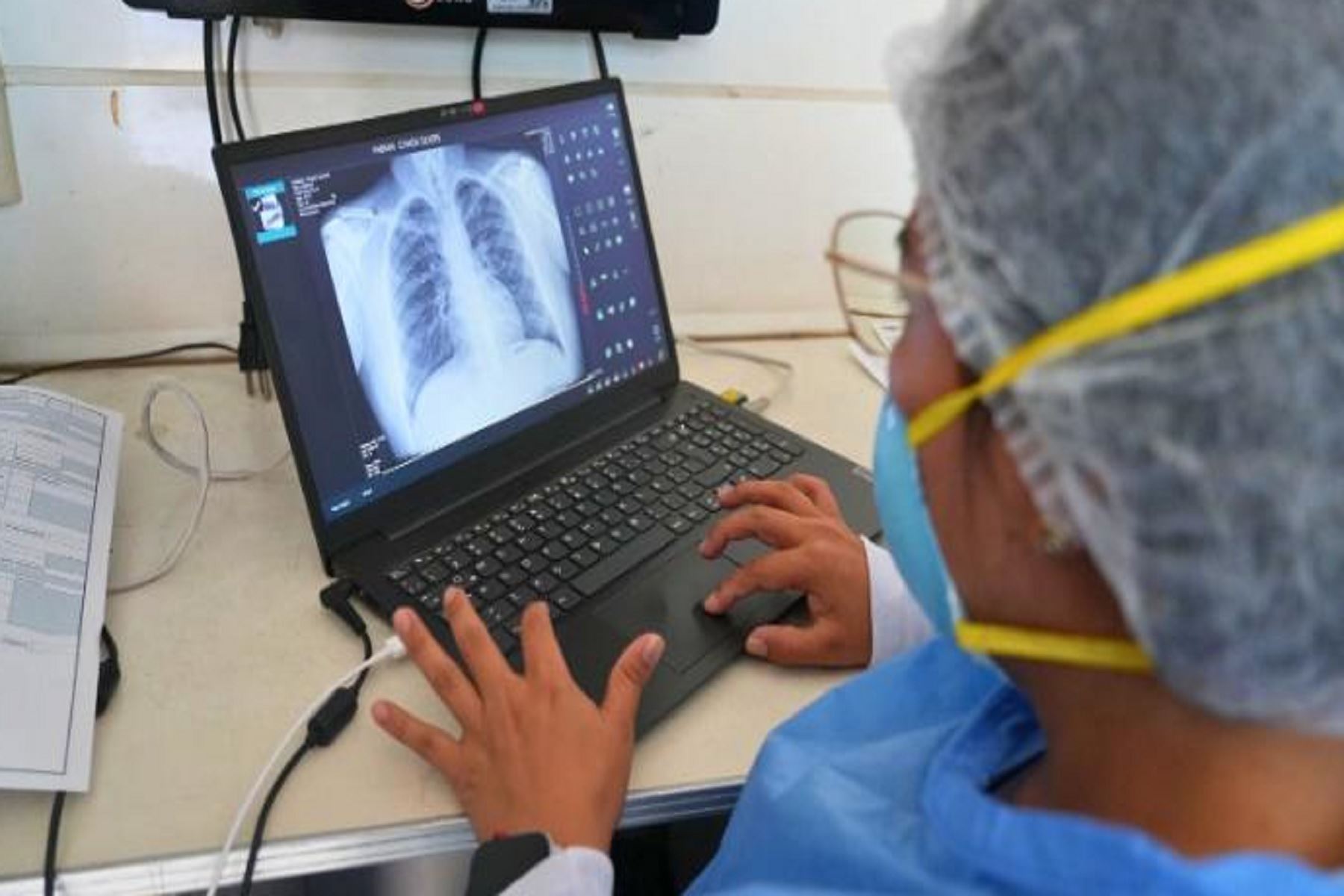 Minsa realiza tamizaje de tuberculosis en instituciones educativas con equipos de IA