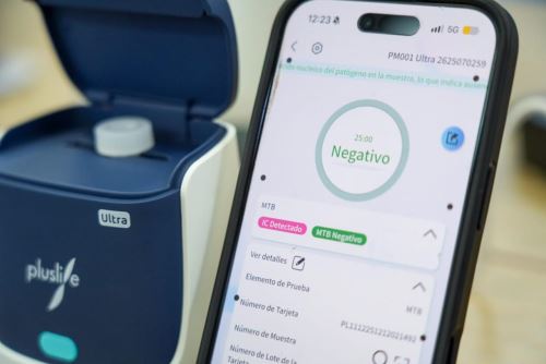 Minsa usa nueva tecnología para detectar tuberculosis en 25 minutos